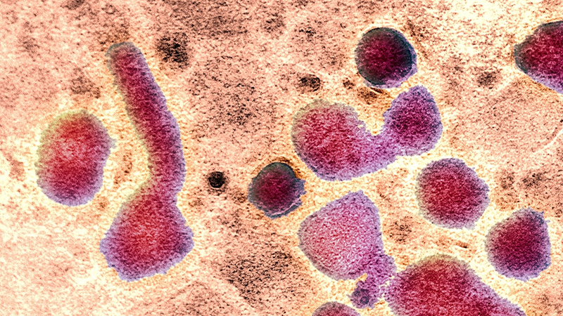 H5N1鳥インフル、単一変異でヒト感染リスク増か　米研究が指摘