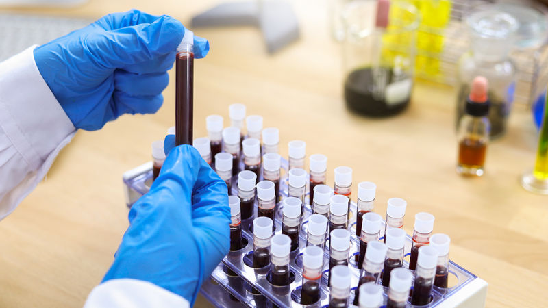 血友病治療の最前線：中国初の遺伝子治療薬BBM-H901が承認