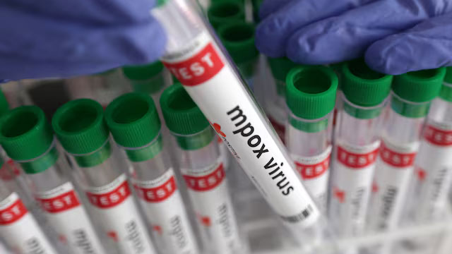 WHO最新報告：mpox世界拡大、アフリカとUAEで深刻な課題に