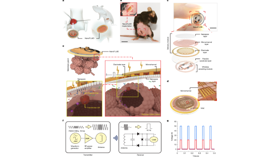 臓器に貼る「電子絆創膏」で薬をピンポイント投与　中国本土の研究チーム