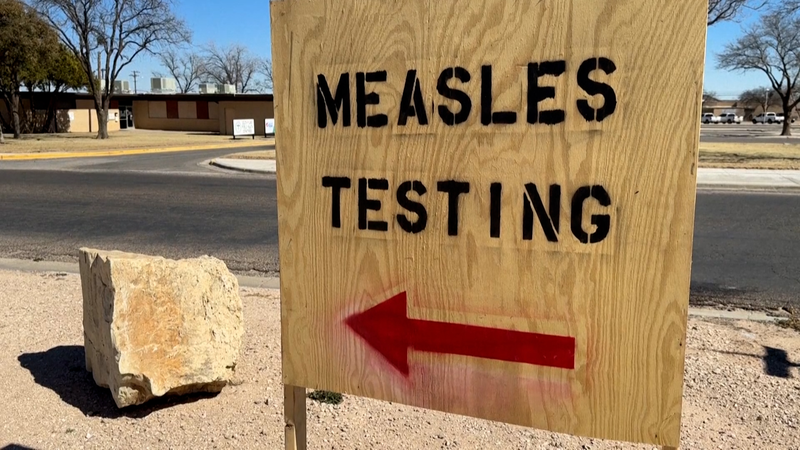 米国で広がるはしか テキサスで何が起きているのか video poster