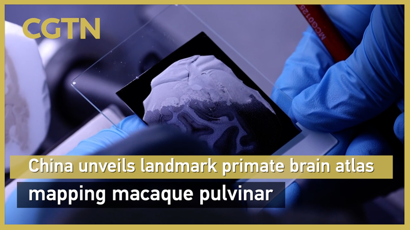 中国主導の国際チーム、霊長類脳アトラスを公開　マカク視床枕を詳細マッピング video poster