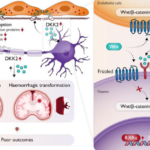 中国本土の研究者、虚血性脳卒中「再灌流後二次損傷」の引き金を特定か