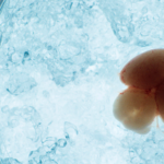 清華大、胎内で胚マウス脳を長時間観察　新しいin vivoイメージング技術