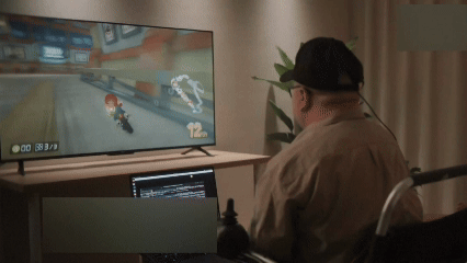 中国の脳コンピューター・インターフェース初の侵襲型手術　思考でゲーム操作