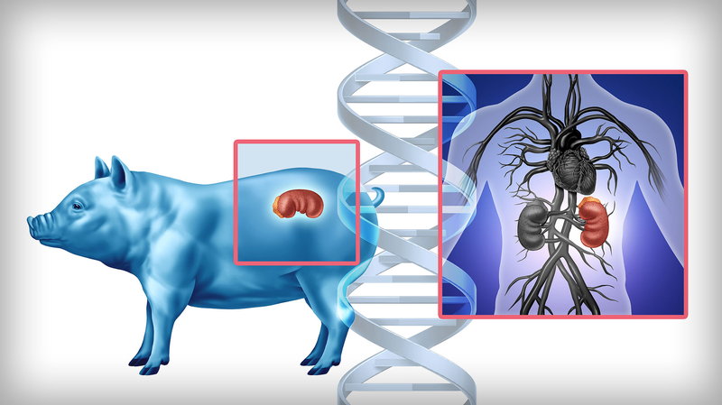中国でブタ腎臓移植が成功 臓器不足に挑む異種移植の最前線