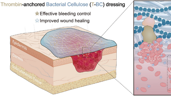 重度熱傷の出血を60秒で止める？中国研究チームが細菌セルロース包帯を開発