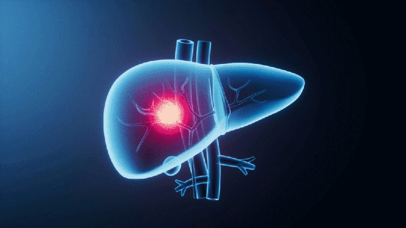 ランセット発・中国主導の世界肝がん対策ロードマップとは