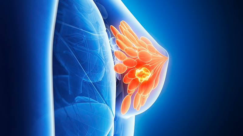 授乳が乳がん予防に？オーストラリア研究が示す免疫の力