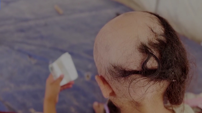 ガザの子どもたちを蝕む心の傷　イスラエル・パレスチナ衝突の影 video poster