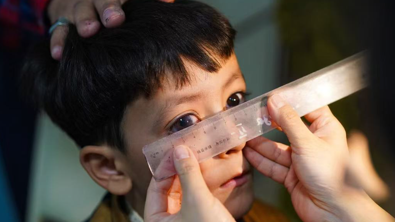 中国の医師が中央アジアで失明危機を救う　北京で写真展