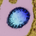 中国、ニパウイルス「国内で未検出」　インド流行受け備え強化