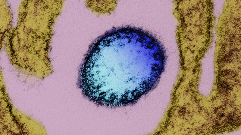 中国、ニパウイルス「国内で未検出」　インド流行受け備え強化