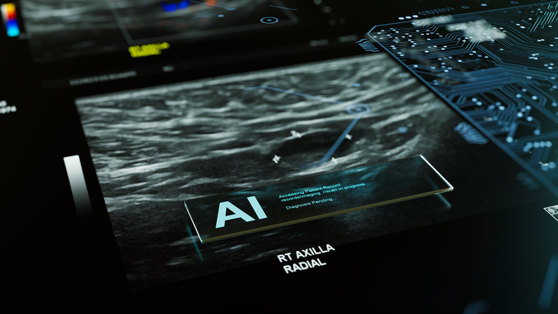 AI支援マンモで乳がん検出9%増 世界初の無作為化試験、スウェーデンで