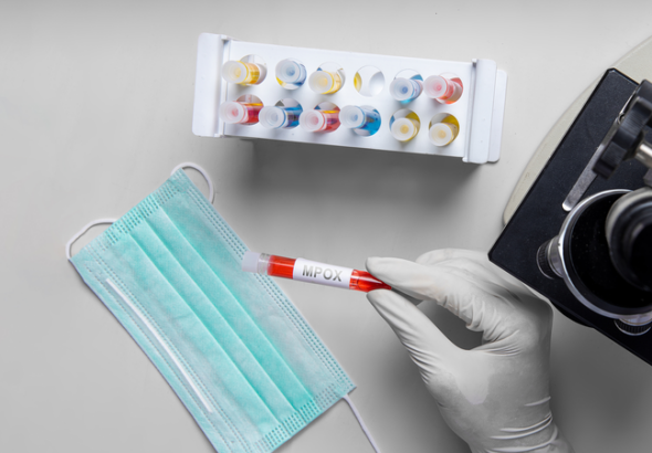 アフリカCDC、mpoxの大陸緊急事態を解除へ：1年半の対応が「転換点」に