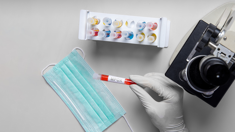 アフリカCDC、mpoxの大陸緊急事態を解除へ：1年半の対応が「転換点」に