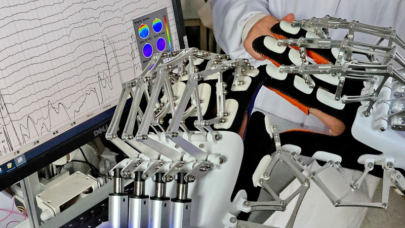 医療BCIは離陸するのか？視覚野刺激で「光」と動きを感じた臨床報告