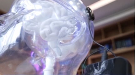 中国、世界初の侵襲型BCI医療機器を承認　脳信号で“つかむ”動作を補助