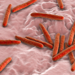 南アフリカ、一滴の血液で30分で結果が出る結核検査デバイスを開発