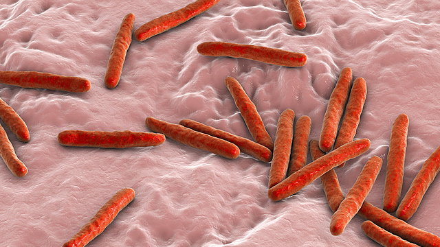 南アフリカ、一滴の血液で30分で結果が出る結核検査デバイスを開発