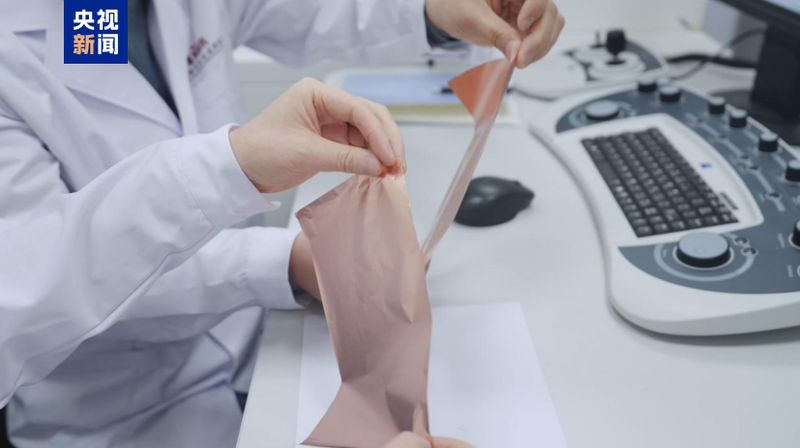 次世代電池に革新、中国が超薄型・超高強度の銅箔を開発